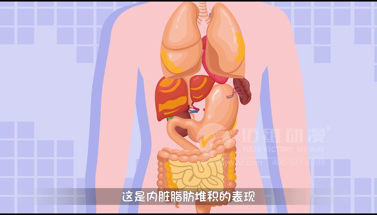 MG動畫，邁維動漫.jpg