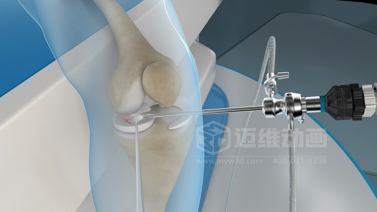 醫(yī)學(xué)手術(shù)三維動(dòng)畫(huà)制作公司哪家好？解碼上海邁維動(dòng)漫的醫(yī)學(xué)醫(yī)療3D可視化創(chuàng)新之路(圖1)