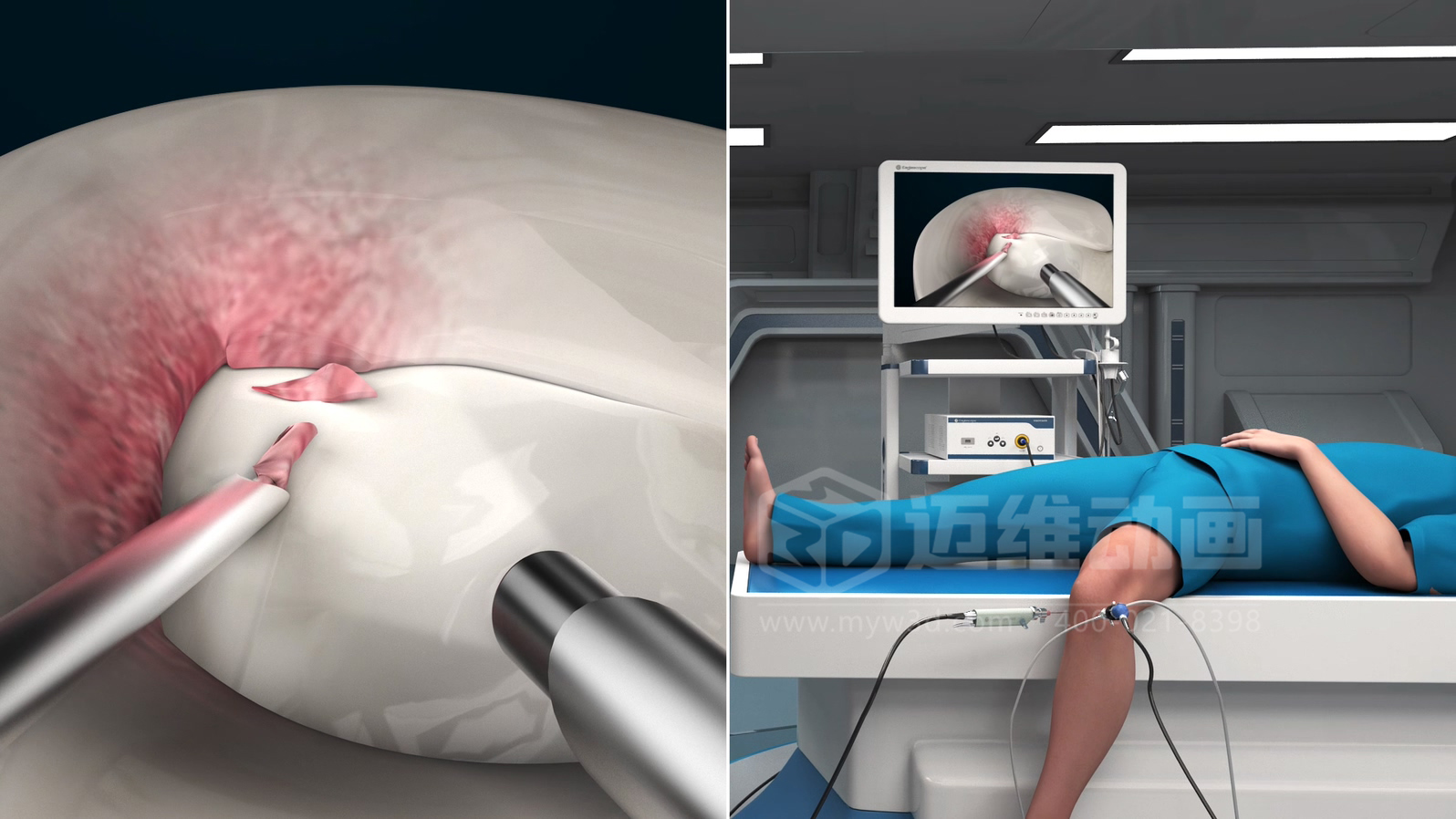 醫(yī)學(xué)手術(shù)三維動(dòng)畫(huà)制作公司哪家好？解碼上海邁維動(dòng)漫的醫(yī)學(xué)醫(yī)療3D可視化創(chuàng)新之路(圖2)